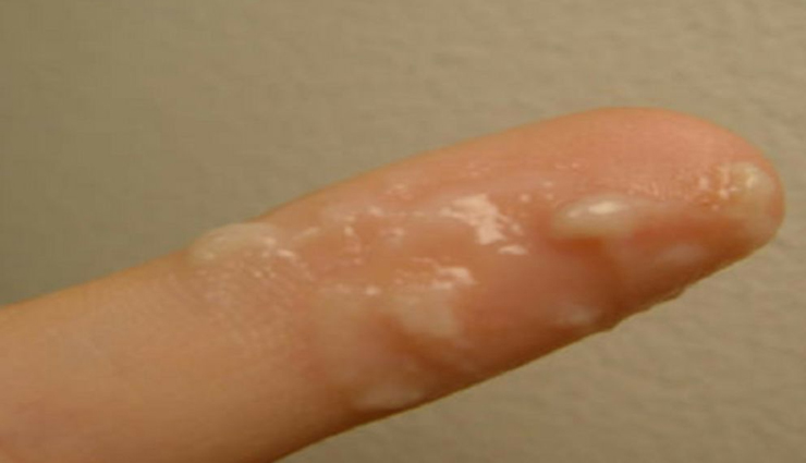 natural birth control pros and cons,pros and cons of using natural birth control,natural family planning advantages and disadvantages,benefits and drawbacks of natural birth control methods,exploring the pros and cons of natural contraception,natural methods of birth control: pros and cons,evaluating natural birth control: benefits and drawbacks,the upsides and downsides of natural birth control,pros and cons of choosing natural family planning,weighing the advantages and disadvantages of natural birth control,natural contraceptive methods: benefits and drawbacks,pros and cons of utilizing natural birth control techniques,the positives and negatives of natural contraception,natural birth control: advantages and disadvantages,natural family planning: pros and cons,pros and cons of opting for natural birth control solutions,a look at the benefits and drawbacks of natural contraception,evaluating the pros and cons of natural birth control methods,natural methods for birth control: exploring the pros and cons,analyzing the benefits and disadvantages of natural family planning