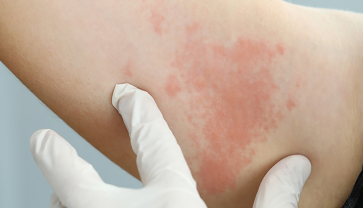 health benefits of mulethi,mulethi,Health tips,fitness tips