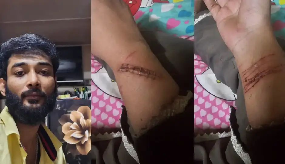 मुंबई में खौफनाक घरेलू हिंसा मामला, पत्नी को 4 घंटे तक प्रताड़ित किया, एसिड से जलाने और हत्या की धमकी, मायके पहुंचने पर भी हमला