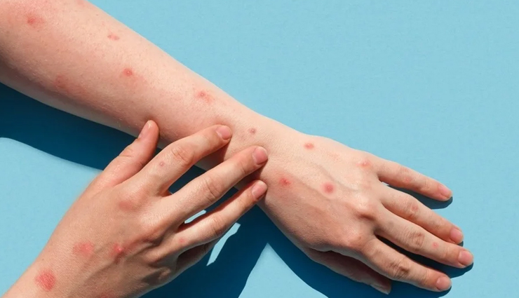 munakka water,health benefits of munakka water,Health tips,fitness tips