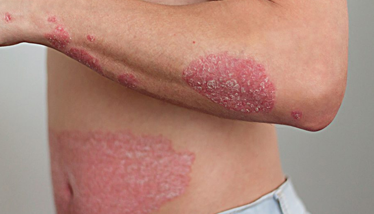 munakka water,health benefits of munakka water,Health tips,fitness tips