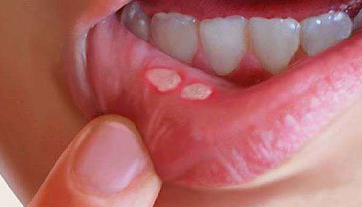 home remedies,rainy season,simple health tips,Health,Health tips