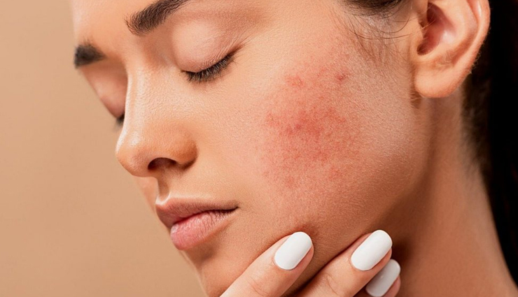 mushroom,beauty benefits of mushroom,beauty tips,skin care tips