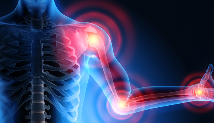 कई बीमारियों का ग्रुप है मायोसाइटिस, धीरे-धीरे तोड़ती है शरीर, डॉक्टर्स के पास नहीं इसका इलाज samantha prabhu,samantha prabhu myocitis disease,myocitis,what is myocitis,samantha prabhu health updates,health news,healthy living