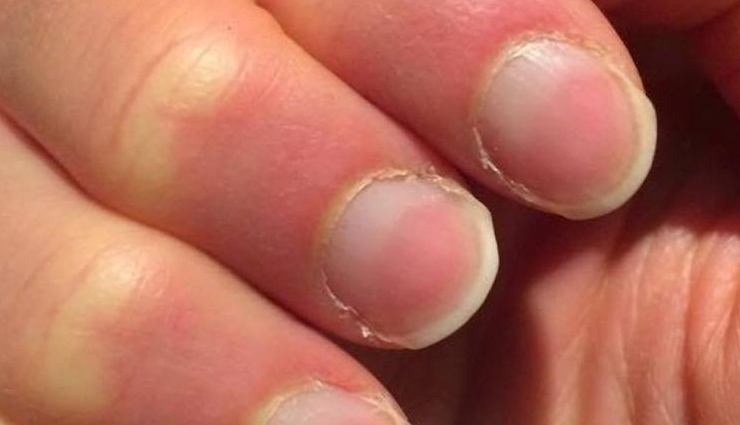 health warnings hands,signs of health issues hands,nail color health warning,swollen fingers health sign,tingling hands causes,dry skin health warning,hand shape deformities,health clues from hands,hands reveal health problems,health conditions visible in hands