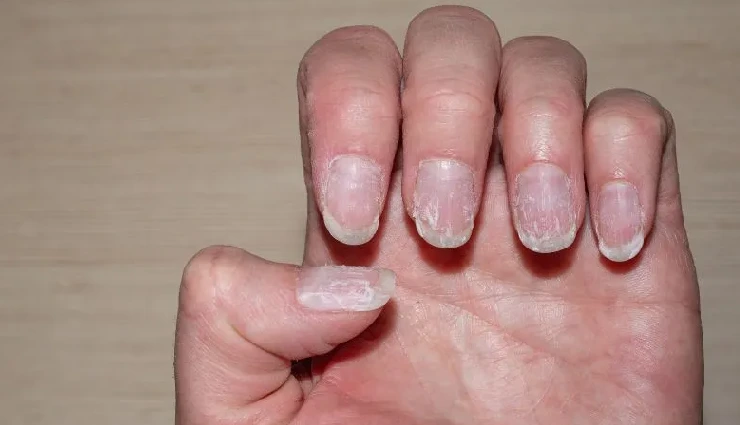 tips for long nails,how to grow strong nails,nail care routine,prevent nail breakage,healthy nail tips,nail growth tips,nail care at home,beauty tips for nails,strong nails naturally,nail maintenance tips