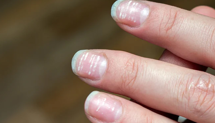 protein deficiency symptoms,muscle deterioration,weakness,edema,swelling,hair,skin,and nails changes,persistent fatigue,delayed wound healing,impaired growth,compromised immune function,vegetarian protein sources,vegan protein sources,elderly protein intake,protein-rich foods,protein benefits,complete protein sources,muscle repair foods,immune-boosting foods,protein-rich diet,protein importance