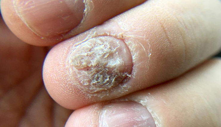 tea tree oil health benefits,uses of tea tree oil for health,tea tree oil benefits guide,health benefits of tea tree essential oil,tea tree oil healing properties,natural health benefits tea tree oil,tea tree oil for wellness,tea tree oil benefits explained