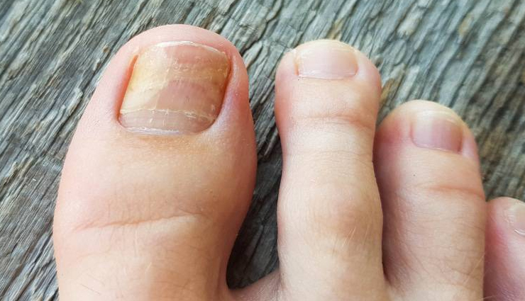 tea tree oil benefits for skin,natural skin care with tea tree oil,antimicrobial properties of tea tree oil for skin,acne treatment with tea tree oil,tea tree oil for oily skin,soothing effects of tea tree oil on skin,tea tree oil for eczema and psoriasis,anti-inflammatory benefits of tea tree oil on skin,tea tree oil for anti-aging and wrinkles,tea tree oil for dark spots and hyperpigmentation