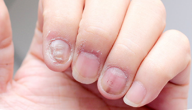 nail polish impact on nails,effects of wearing nail polish,nail polish consequences on nails,what happens to nails with nail polish,nail polish and nail health,nail polish damage to nails,nail enamel impact on nails,consequences of frequent nail polish use,nail polish side effects,nails after prolonged nail polish wear,long-term effects of nail lacquer,health risks of continuous nail polish application,nail polish wear and tear on nails,nail polish residue effects,nail health and polish use consequences