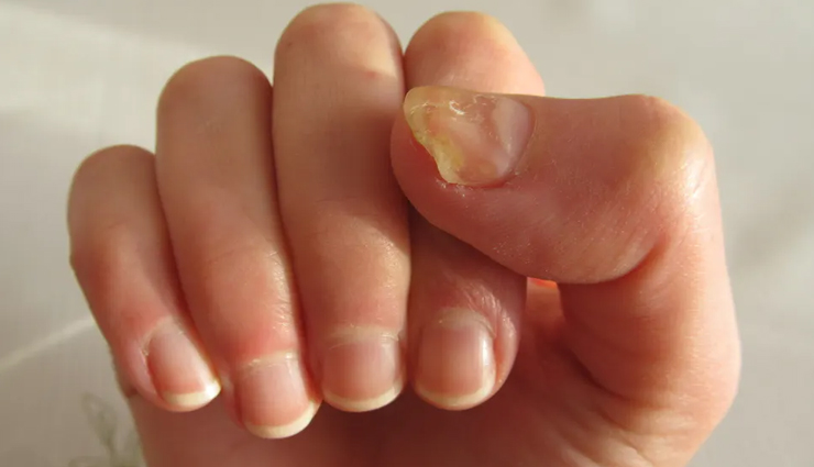 nails care tips,beauty tips,beauty hacks