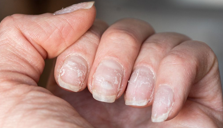 home remedies to get rid of brittle and chipped nails,nails care tips,beauty tips