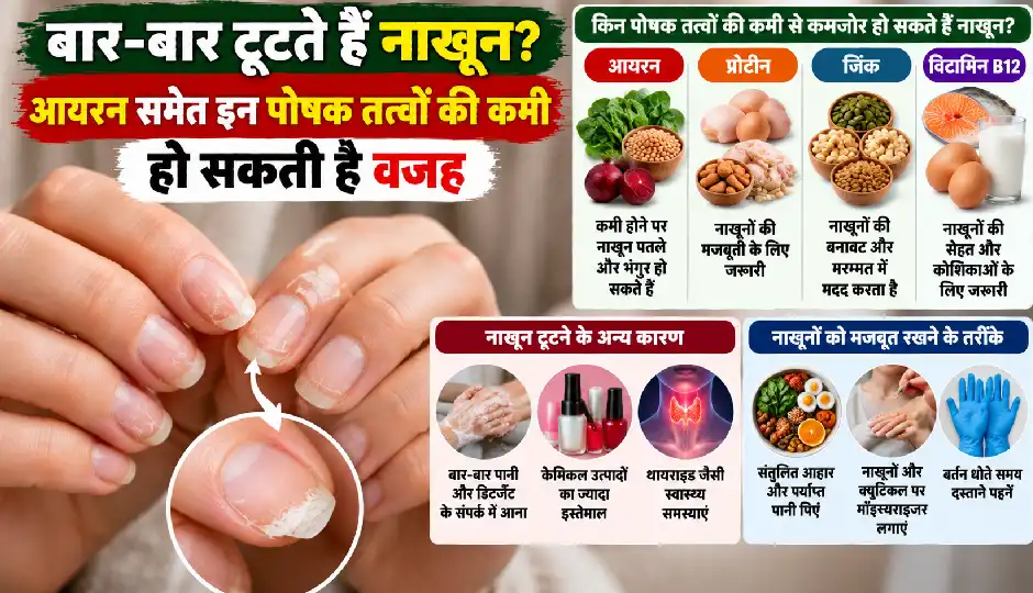बार-बार टूटते हैं नाखून? आयरन समेत इन पोषक तत्वों की कमी हो सकती है वजह