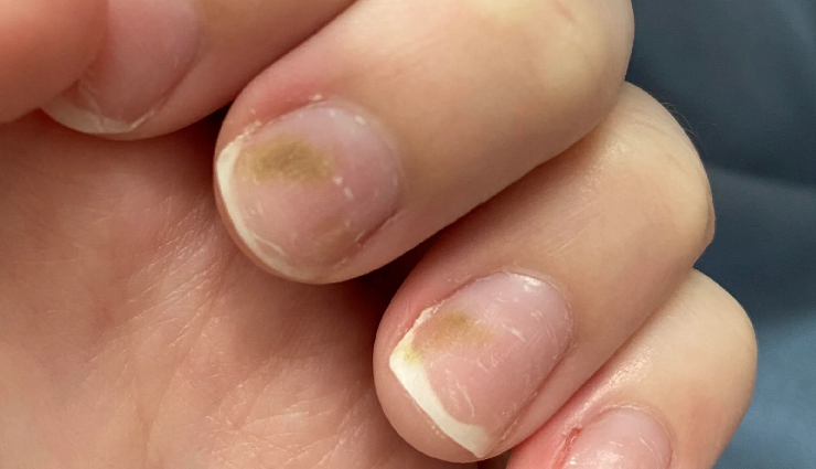 nail polish impact on nails,effects of wearing nail polish,nail polish consequences on nails,what happens to nails with nail polish,nail polish and nail health,nail polish damage to nails,nail enamel impact on nails,consequences of frequent nail polish use,nail polish side effects,nails after prolonged nail polish wear,long-term effects of nail lacquer,health risks of continuous nail polish application,nail polish wear and tear on nails,nail polish residue effects,nail health and polish use consequences