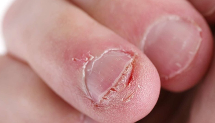 पाना चाहती हैं लंबे और खूबसूरत नाखून, ले इन 5 घरेलू उपायों की मदद strong nails tips,natural nail growth remedies,home remedies for nails,grow nails naturally fast,nutrients for nail growth,natural oils for nails,foods for nail nourishment,diy nail care recipes,healthy nail growth habits,natural nail supplements