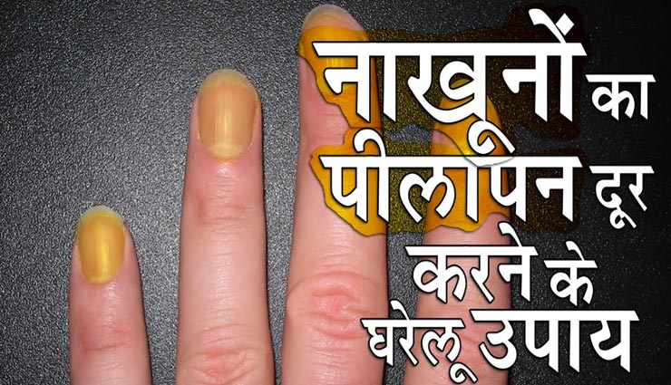 क्या आपको भी सता रहा नाखूनों का पीलापन, आसान नुस्खों से पाए इनकी खूबसूरती