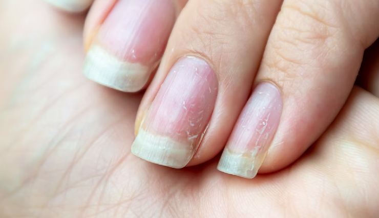 nail polish impact on nails,effects of wearing nail polish,nail polish consequences on nails,what happens to nails with nail polish,nail polish and nail health,nail polish damage to nails,nail enamel impact on nails,consequences of frequent nail polish use,nail polish side effects,nails after prolonged nail polish wear,long-term effects of nail lacquer,health risks of continuous nail polish application,nail polish wear and tear on nails,nail polish residue effects,nail health and polish use consequences