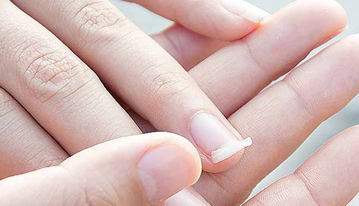 uses of baking soda,baking soda benefits,baking soda home remedies,baking soda health benefits,baking soda for cleaning,baking soda in beauty,baking soda diy tips,baking soda for everyday use,baking soda for hair care,baking soda natural remedies,baking soda beauty benefits,baking soda for glowing skin,baking soda for acne treatment,baking soda for dark spots,baking soda for blackheads,baking soda for teeth whitening,baking soda face mask,baking soda beauty hacks,baking soda for skin whitening,baking soda for clear skin,baking soda for skin care,baking soda for sensitive skin,baking soda face scrub,baking soda for skin exfoliation,baking soda for skin rashes,baking soda for oily skin,baking soda for dry skin,baking soda for smooth skin,baking soda skin treatment,baking soda skin care routine,how to use baking soda for skin,benefits of baking soda for skin,baking soda skin care tips,baking soda for skin blemishes,baking soda for skin lightening,baking soda for skin irritation,baking soda face wash,baking soda skin cleansing,baking soda for skin problems,using baking soda for healthy skin,त्वचा की देखभाल के टिप्स,त्वचा की सुंदरता के टिप्स,हिंदी में त्वचा की देखभाल,ग्लोइंग स्किन के लिए टिप्स,त्वचा की चमक के लिए घरेलू नुस्खे,हिंदी में स्किन केयर टिप्स,नेचुरल स्किन केयर टिप्स हिंदी में,साफ त्वचा के लिए टिप्स,सुंदर त्वचा के लिए उपाय,हिंदी में त्वचा की देखभाल के उपाय