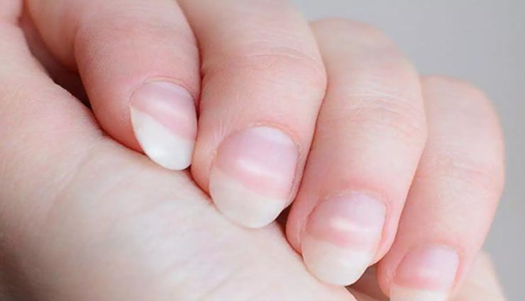 astrology tips,astrology tips in hindi,palmistry,nails sign