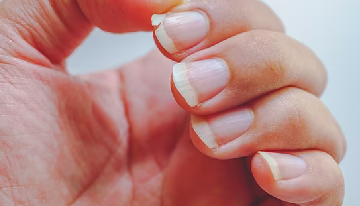 nail polish impact on nails,effects of wearing nail polish,nail polish consequences on nails,what happens to nails with nail polish,nail polish and nail health,nail polish damage to nails,nail enamel impact on nails,consequences of frequent nail polish use,nail polish side effects,nails after prolonged nail polish wear,long-term effects of nail lacquer,health risks of continuous nail polish application,nail polish wear and tear on nails,nail polish residue effects,nail health and polish use consequences