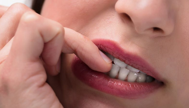 आपकी ये आदतें बनती हैं दांतों की परेशानियों का कारण, इनमें सुधार करना बहुत जरूरी tooth-damaging behaviors,oral health-harming practices,teeth-harming routines,habits that harm dental hygiene,harmful oral care practices,dental health detrimental habits,teeth-damaging lifestyle choices,oral habits impacting teeth negatively,detrimental dental behaviors,harmful routines for teeth