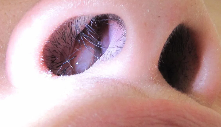 blocked nose,causes of blocked nose,major causes of blocked nose,nose care,nose treatment,Health,Health tips