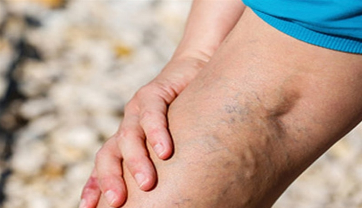 health risks of drinking warm water,side effects of consuming warm water continuously,drinking warm water cons,negative impacts on health,risks of excessive warm water intake,harmful effects of warm water throughout the day,consequences of drinking warm water,health hazards from excessive warm water consumption,why warm water may be harmful,excessive warm water and health issues,is warm water harmful in excess?,dangers of drinking warm water continuously,health consequences of warm water overconsumption,overdoing warm water: effects on the body,excessive warm water and its impact on health,the dark side of drinking warm water,risks associated with prolonged warm water consumption,drawbacks of consistent warm water intake,potential adverse effects of warm water on the body,warm water overindulgence: what you should know