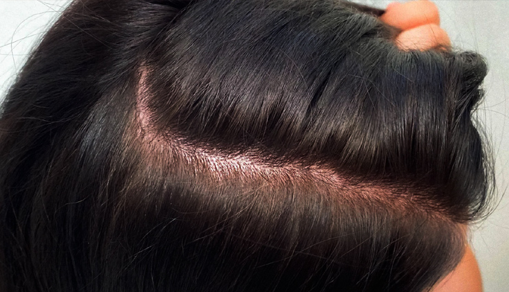 eggs,eggs for hair,hair care tips,hair beauty,hair beauty,hair health,healthy hair,beauty tips