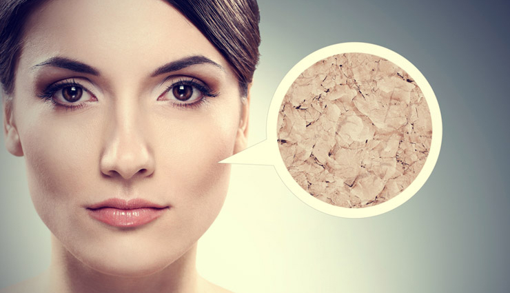 6 DIY Natural Toners for Dull and Dry Skin