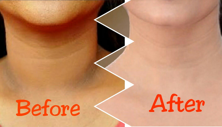 beauty tips,how to remove darkness from neck