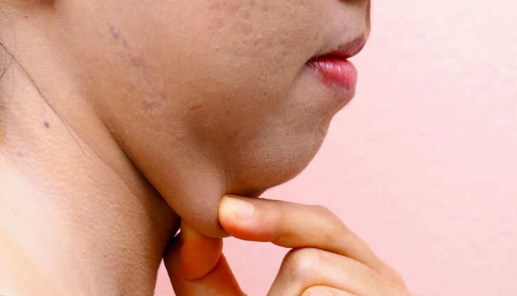 neck fat,exercises for neck fat,fat burning exercises,Health tips,fitness tips