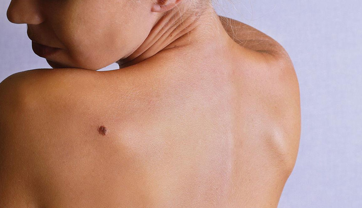 home remedies,home remedies for neck cleaning,neck whitening tips,beauty tips,skin care tips