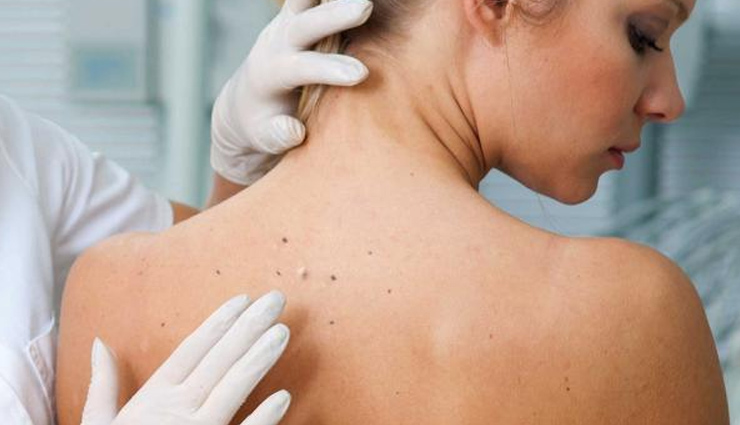 home remedies,home remedies for neck cleaning,neck whitening tips,beauty tips,skin care tips