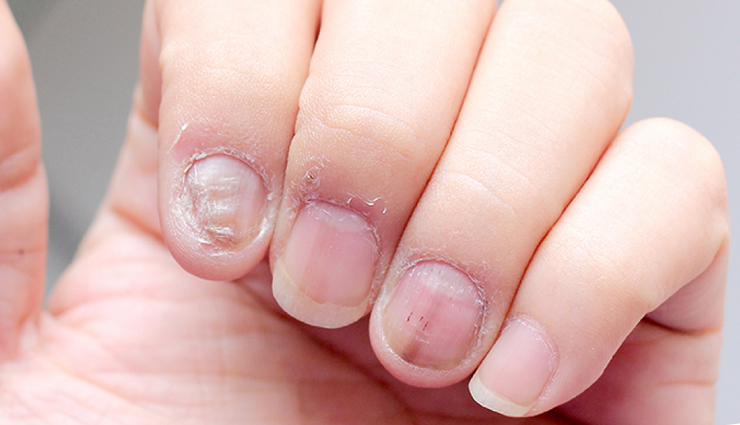 neem oil benefits,neem oil uses,pure neem oil for skin,cold pressed neem oil,neem oil health benefits,neem oil safety,neem oil natural remedy,neem oil skincare,neem oil side effects,neem oil medicinal uses