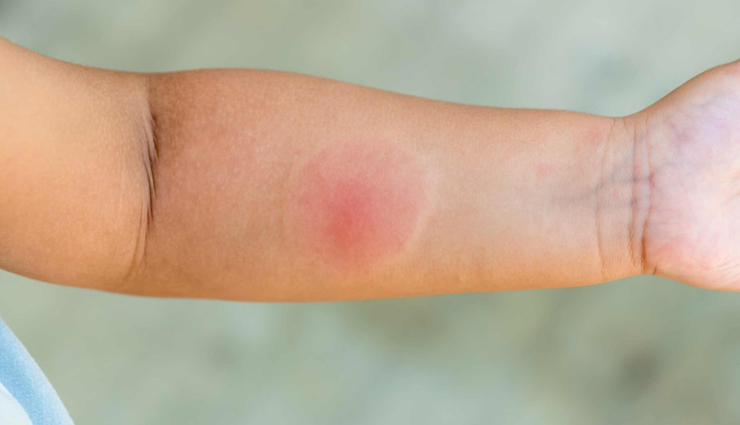 neem oil benefits,neem oil uses,pure neem oil for skin,cold pressed neem oil,neem oil health benefits,neem oil safety,neem oil natural remedy,neem oil skincare,neem oil side effects,neem oil medicinal uses