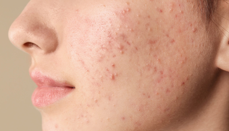 neem oil beauty benefits,neem oil skincare benefits,neem oil for glowing skin,neem oil for clear skin,neem oil acne treatment,neem oil for acne scars,neem oil anti-aging properties,neem oil haircare benefits,neem oil scalp treatment,neem oil for hair growth,neem oil for dandruff,neem oil natural skincare,neem oil facial serum,neem oil moisturizer,neem oil face mask,neem oil beauty hacks,neem oil diy beauty recipes,neem oil natural remedies,neem oil organic beauty,neem oil sustainable beauty