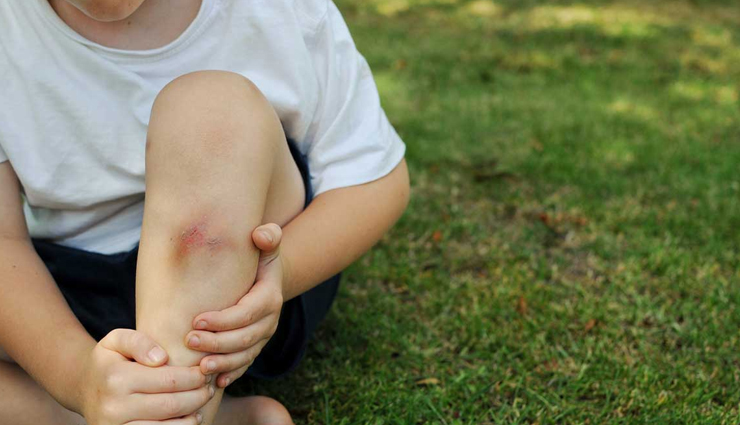 neem oil beauty benefits,neem oil skincare benefits,neem oil for glowing skin,neem oil for clear skin,neem oil acne treatment,neem oil for acne scars,neem oil anti-aging properties,neem oil haircare benefits,neem oil scalp treatment,neem oil for hair growth,neem oil for dandruff,neem oil natural skincare,neem oil facial serum,neem oil moisturizer,neem oil face mask,neem oil beauty hacks,neem oil diy beauty recipes,neem oil natural remedies,neem oil organic beauty,neem oil sustainable beauty