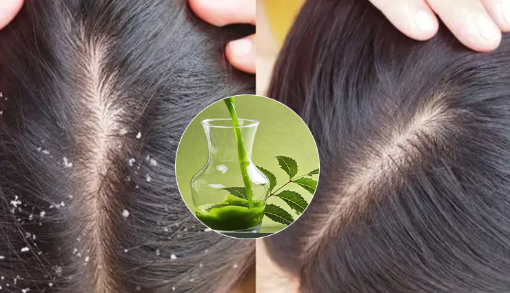 ayurvedic hair remedies,ayurvedic treatments for healthy hair,ayurvedic remedies hair growth,natural ayurvedic hair care,diy ayurvedic hair solutions,ayurvedic hair health tips,ayurvedic oils for hair,ayurvedic herbs for hair growth,traditional ayurvedic hair care,ayurvedic hair masks