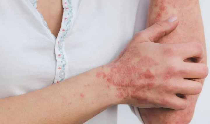 neem skincare benefits,using neem for skin problems,neem remedies for skin issues,how to use neem for skin care,neem for acne and pimples,neem face mask recipes,neem oil for skin ailments,natural neem skincare tips,neem leaves for healthy skin,neem extract for dermatological concerns,neem skincare routine,neem benefits for clear skin,neem properties for skin health,neem leaf paste for skin problems,neem-infused skincare products,neem remedies for eczema and psoriasis,neem face wash benefits,neem for glowing skin,neem for dark spots and blemishes,neem oil benefits for skin