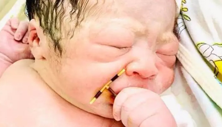 New Born Baby Holding Mothers Failed Coil Goes Viral