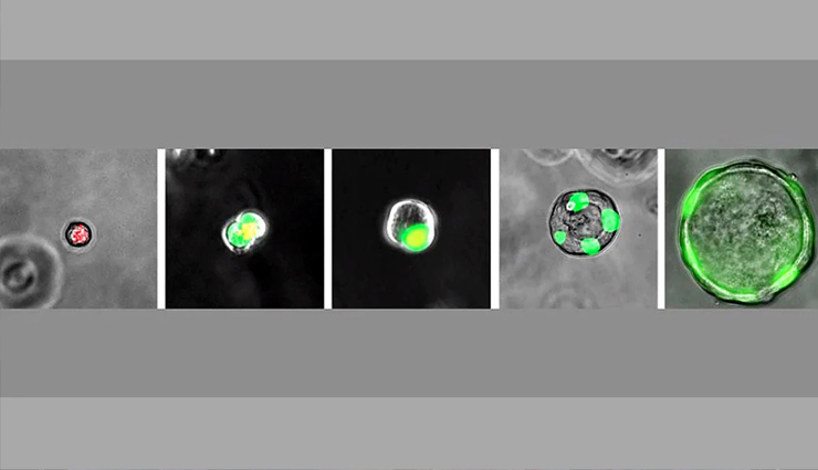 human lungs,new organ found,respiratory airway secretory - ras,health news