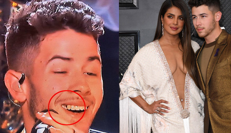 निक जोनास के दांतों में फंसा खाना देख ट्विटर पर लोगों ने लिए मजे, मिला ये जवाब