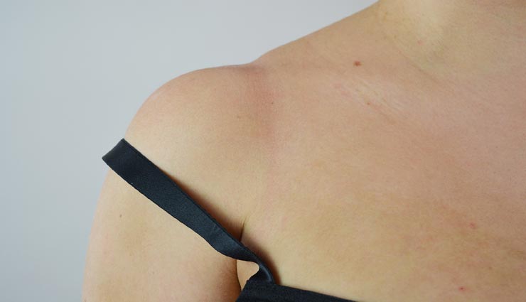 beauty tips,beauty tips in hindi,home remedies,strap marks