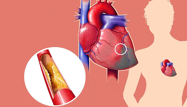 nopal cactus,health benefits of nopal cactus,Health tips,fitness tips