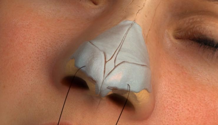 खूबसूरती की चाहत में कटवानी पड़ी दोनों टांगें, किस्सा हैरान करने वाला