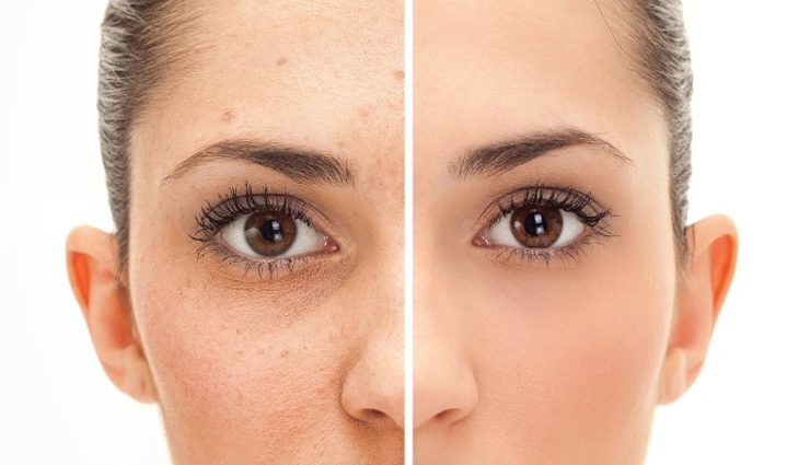 diy oatmeal face packs,problem free skin,skin care tips,beauty tips