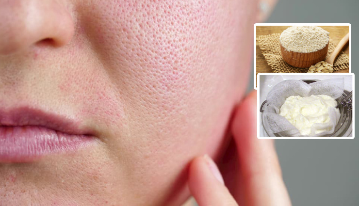 diy face masks,homemade face masks,natural face masks,2 ingredient face masks,glowing skin,healthy skin,skin care,beauty tips,skin problems,blackheads,oily skin,acne,aging,skin tightening,deep cleaning pores,clear skin,brighten skin,reduce dark spots,hydrate skin,exfoliate skin