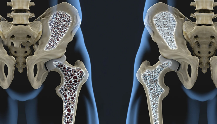 low risk conditions associated with obesity,obesity,Health tips,fitness tips