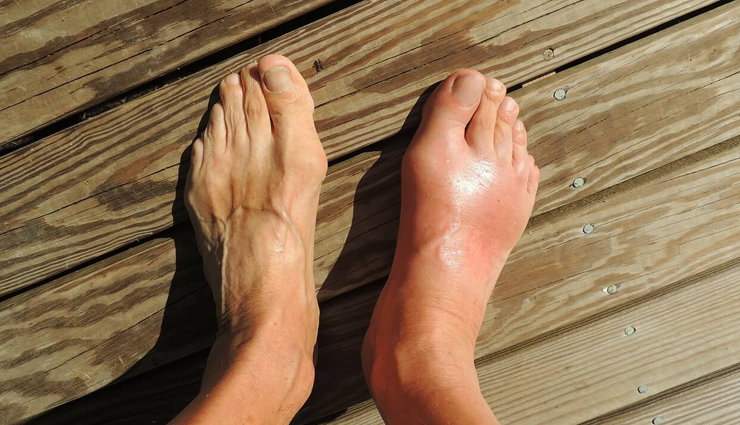 low risk conditions associated with obesity,obesity,Health tips,fitness tips