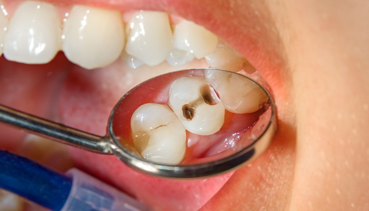 low risk conditions associated with obesity,obesity,Health tips,fitness tips